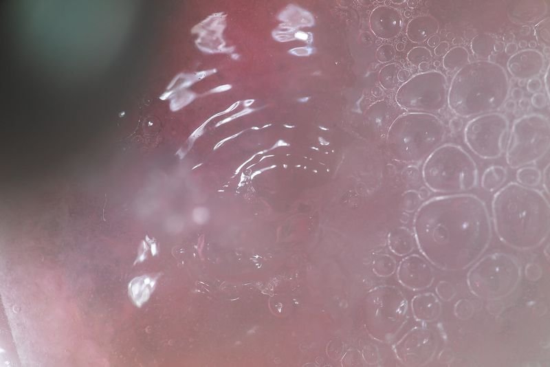 resources of Cellulase exporters