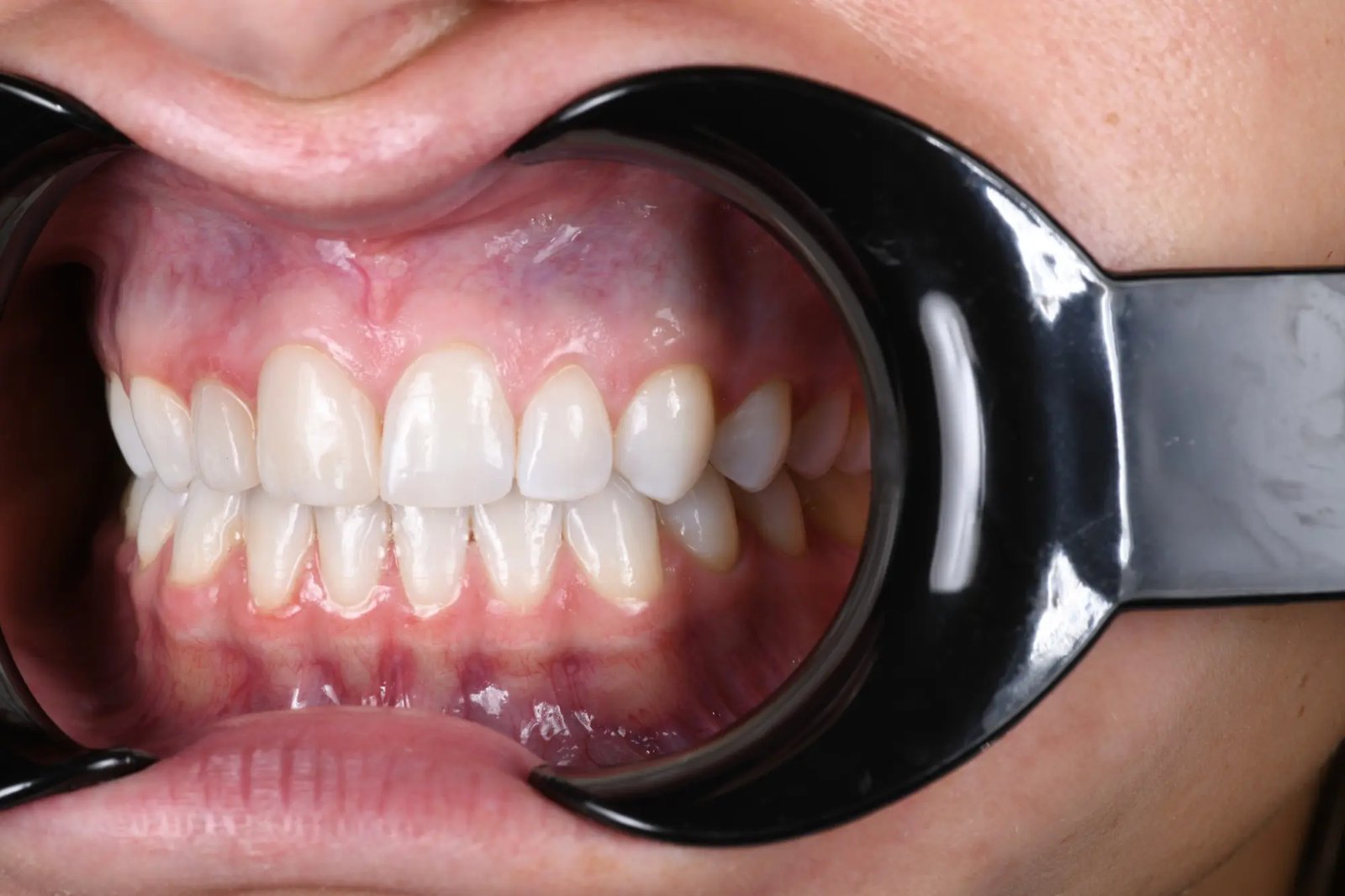 resources of Oral examine camera exporters