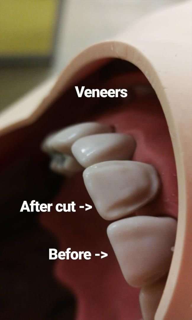 resources of Face Veneer Log Peeling Machine exporters