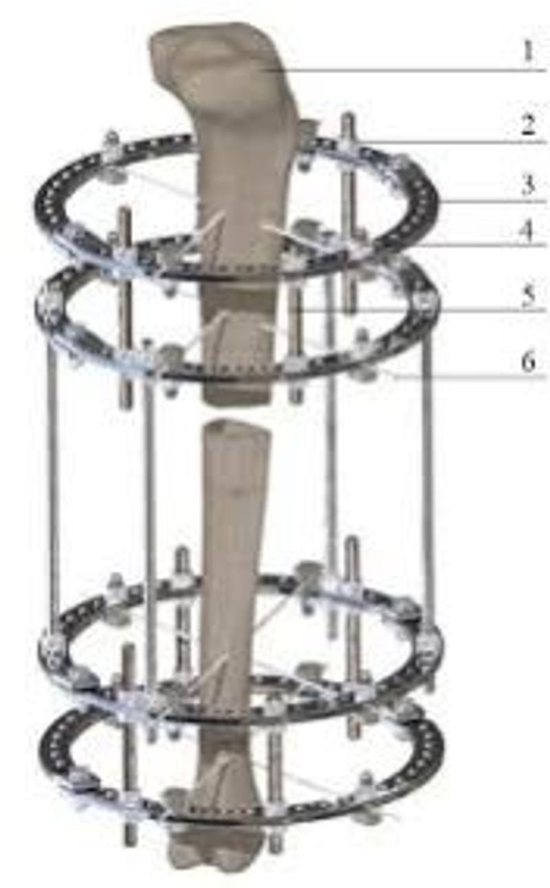 resources of Round Balustrade Systems exporters