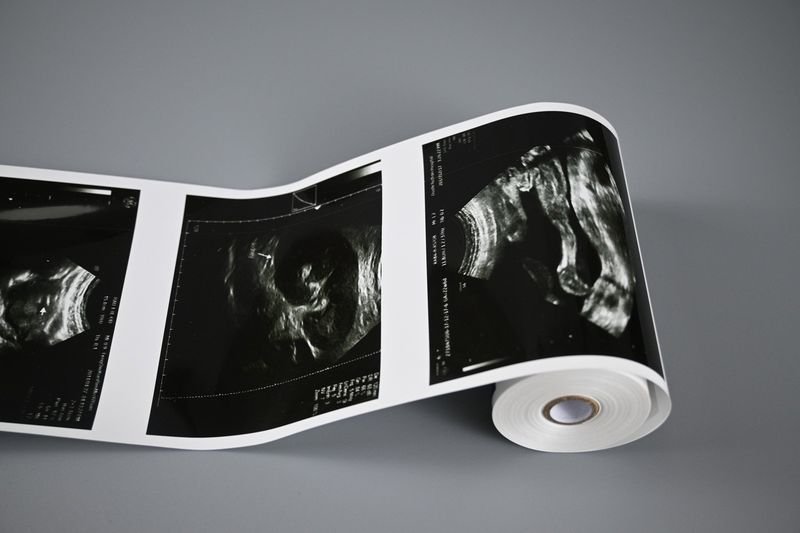 resources of Full-Digital Swine, Ovine Ultrasound Scanner exporters