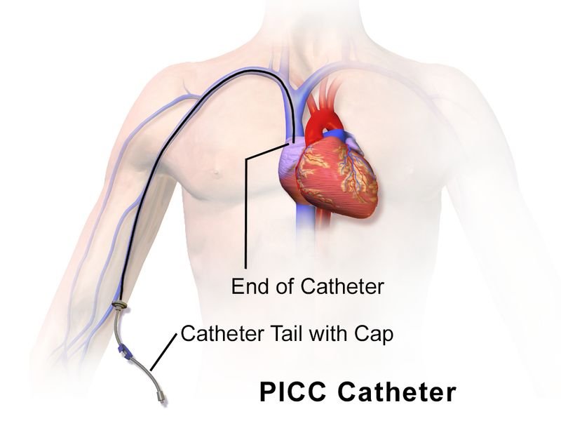 resources of Non Compliant PTCA Balloon Catheter exporters resources of Non Compliant PTCA Balloon Catheter exporters