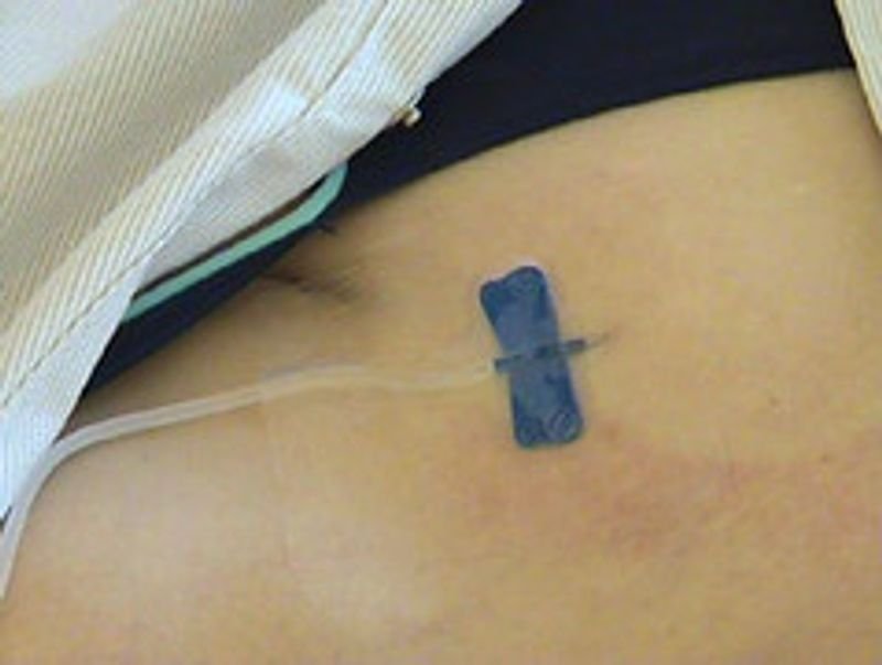 resources of Medical infusion pump with drug library CE mark exporters