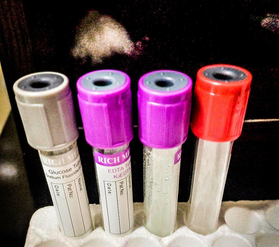 Medical Tubes Exporters, Wholesaler & Manufacturer | Globaltradeplaza.com
