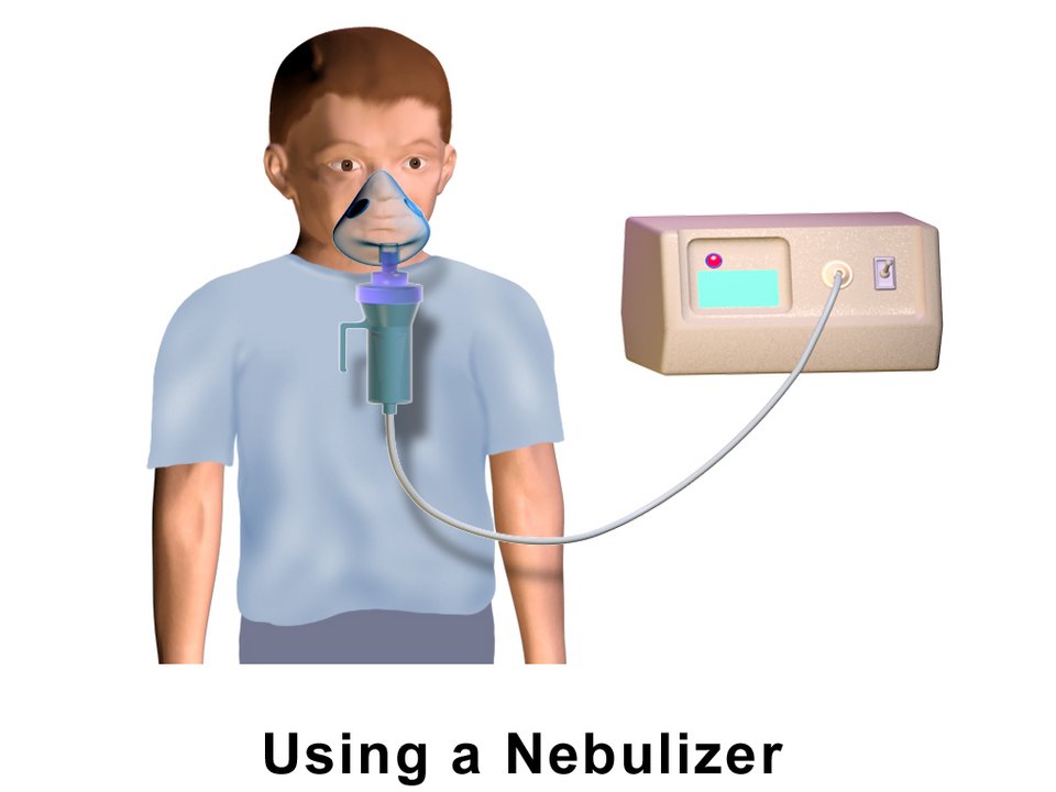 resources of Nebulizer Kit - Nb-604 exporters