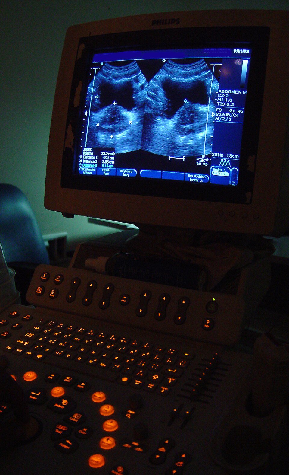 Ultrasound Systems Exporters, Wholesaler & Manufacturer | Globaltradeplaza.com