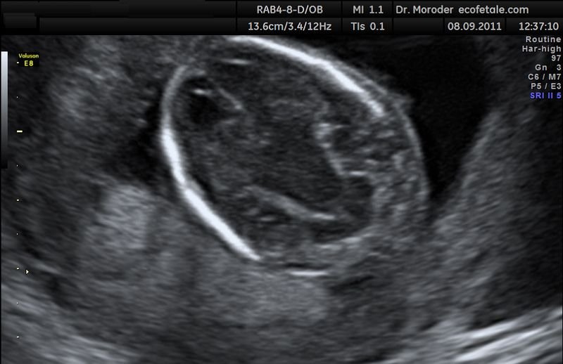resources of Vet Ultrasound Scanner ECI-V2 exporters