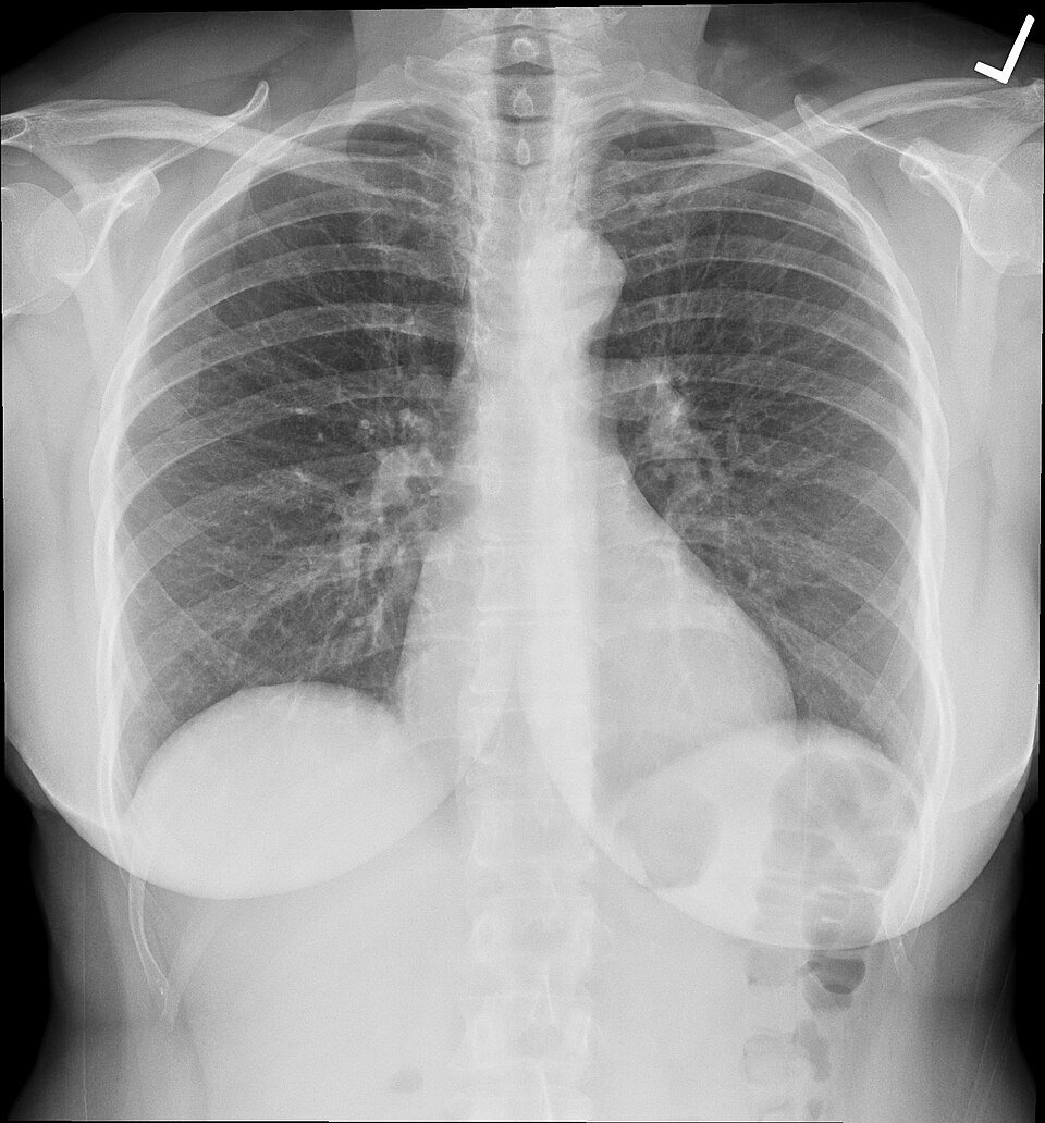 X-ray Films Exporters, Wholesaler & Manufacturer | Globaltradeplaza.com
