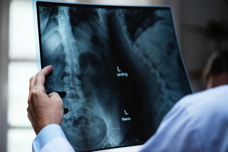 resources of Bone density exporters