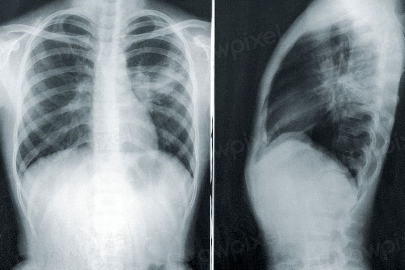 resources of Coronary Ostial Perfusion Cannulae exporters